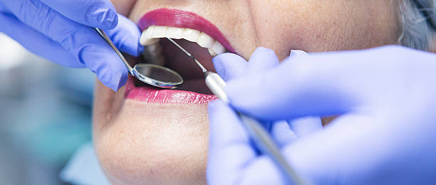 Best Emergency Tooth Extraction  in Vernon, AL